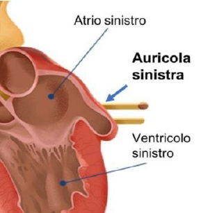 auricola sinistra