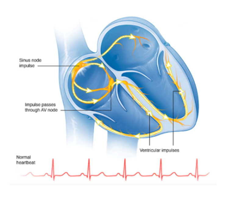 nodo atrio ventricolare
